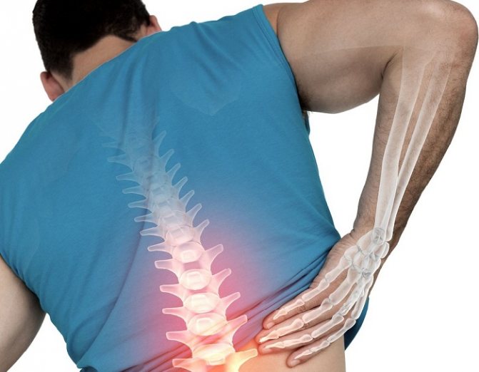Боль в спине - болевые синдромы - отвечает магазин медтехники MED-TEMA.RU