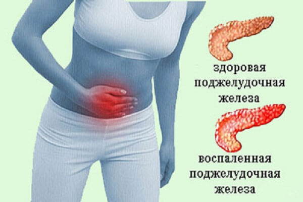 Кожные симптомы больной поджелудочной железы - поясняет магазин медтехники ME-D.RU